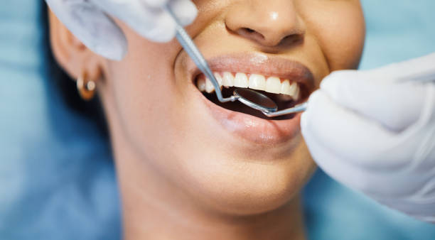 Best Emergency Denture Repair in Merced, CA